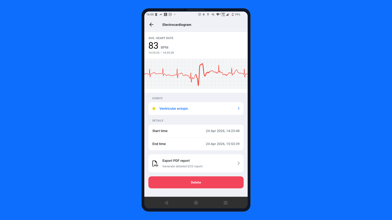 Aidlab mobile ECG analysis preview