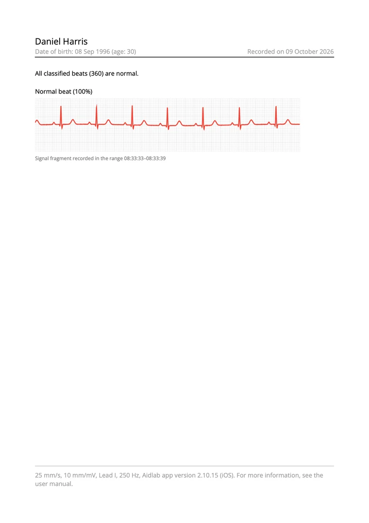 Sample ECG PDF report preview with timeline details