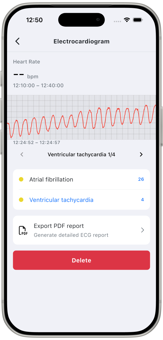 Electrocardiogram component
